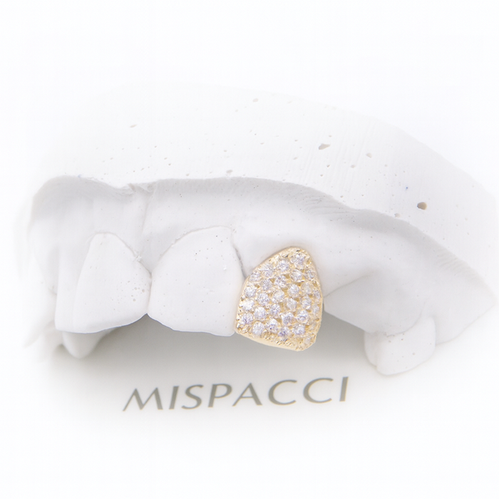 Single Iced Out Grillz - Gold