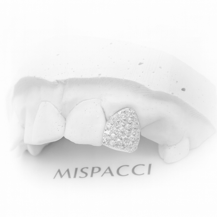 Single Iced Out Grillz